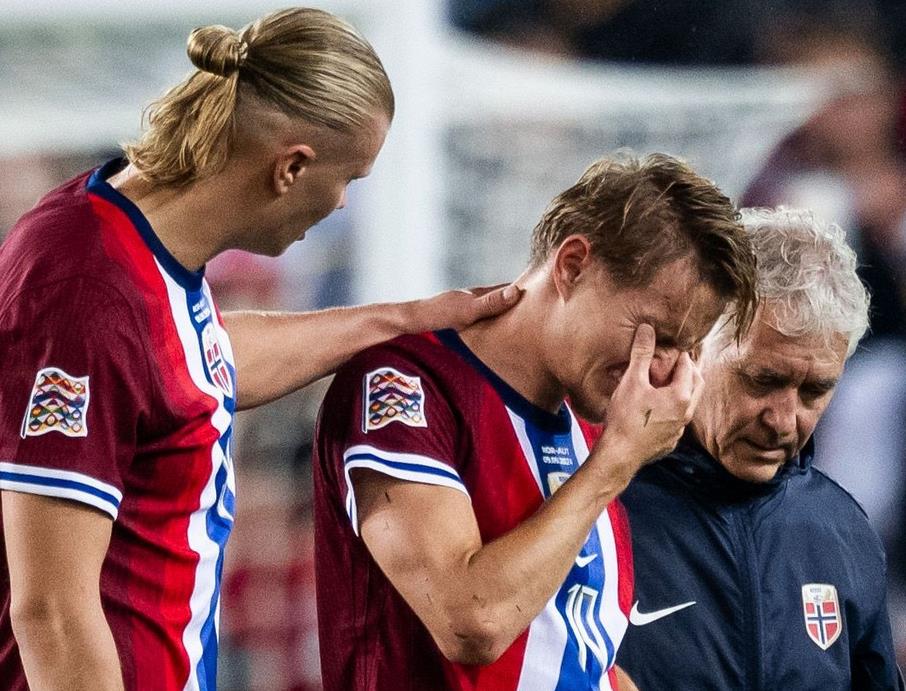 Kabar Buruk untuk Arsenal, Martin Odegaard Cedera kala Membela Timnas Norwegia