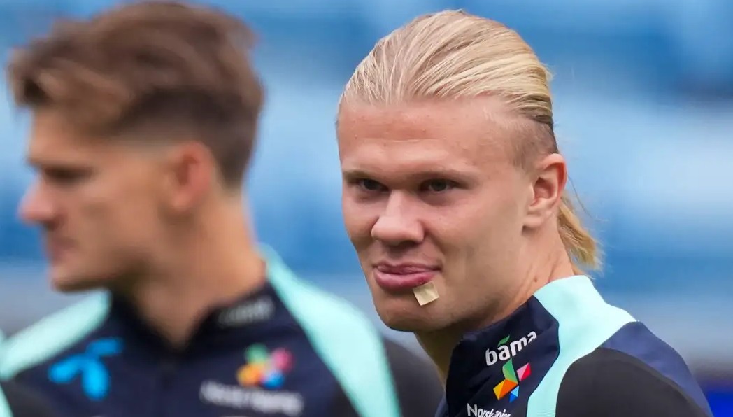 Terluka dan Harus Mendapatkan Tiga Jahitan, Erling Haaland 'Salahkan' Martin Odegaard
