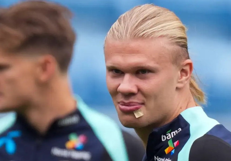 Terluka dan Harus Mendapatkan Tiga Jahitan, Erling Haaland 'Salahkan' Martin Odegaard