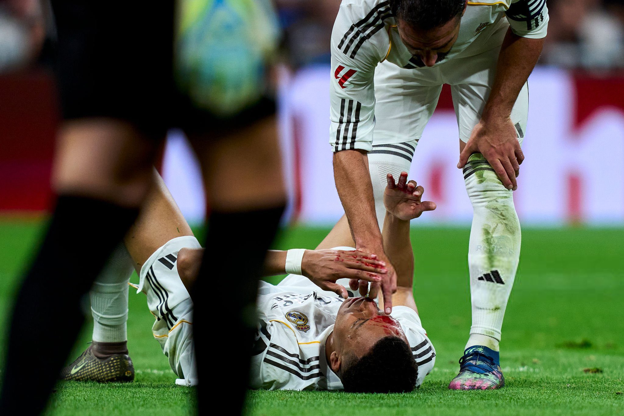 Kepala Mbappe Sampai Berdarah, Arbeloa: Di Bulan Pun Real Madrid Harusnya Dapat Penalti