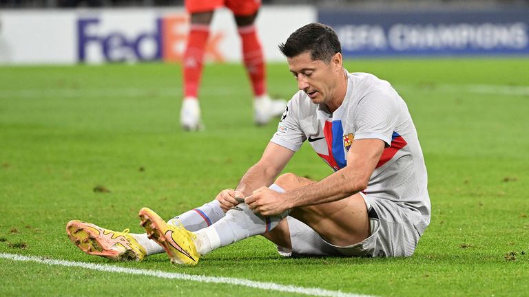 Julian Nagelsmann: Bayern Munchen Lebih Bagus Tanpa Robert Lewandowski