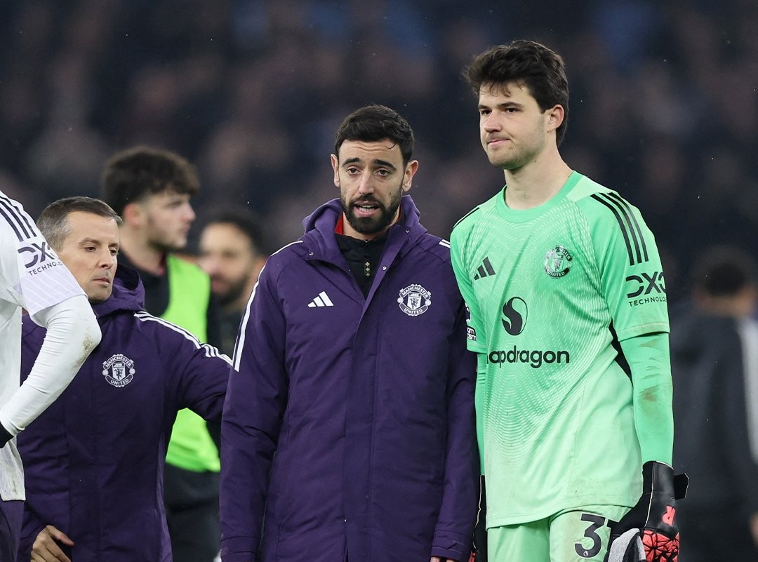 Manchester United Tidak Terbiasa Kehilangan Bruno Fernandes