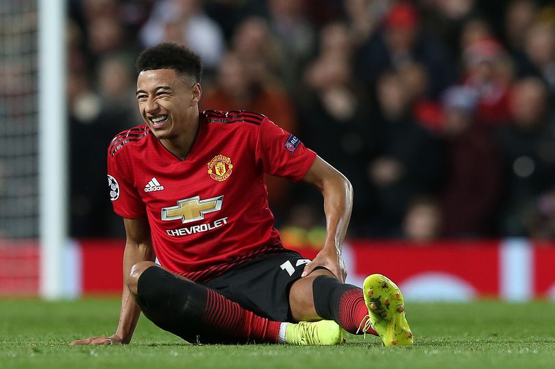 Anthony Martial dan Jesse Lingard Absen Lawan Chelsea dan Liverpool