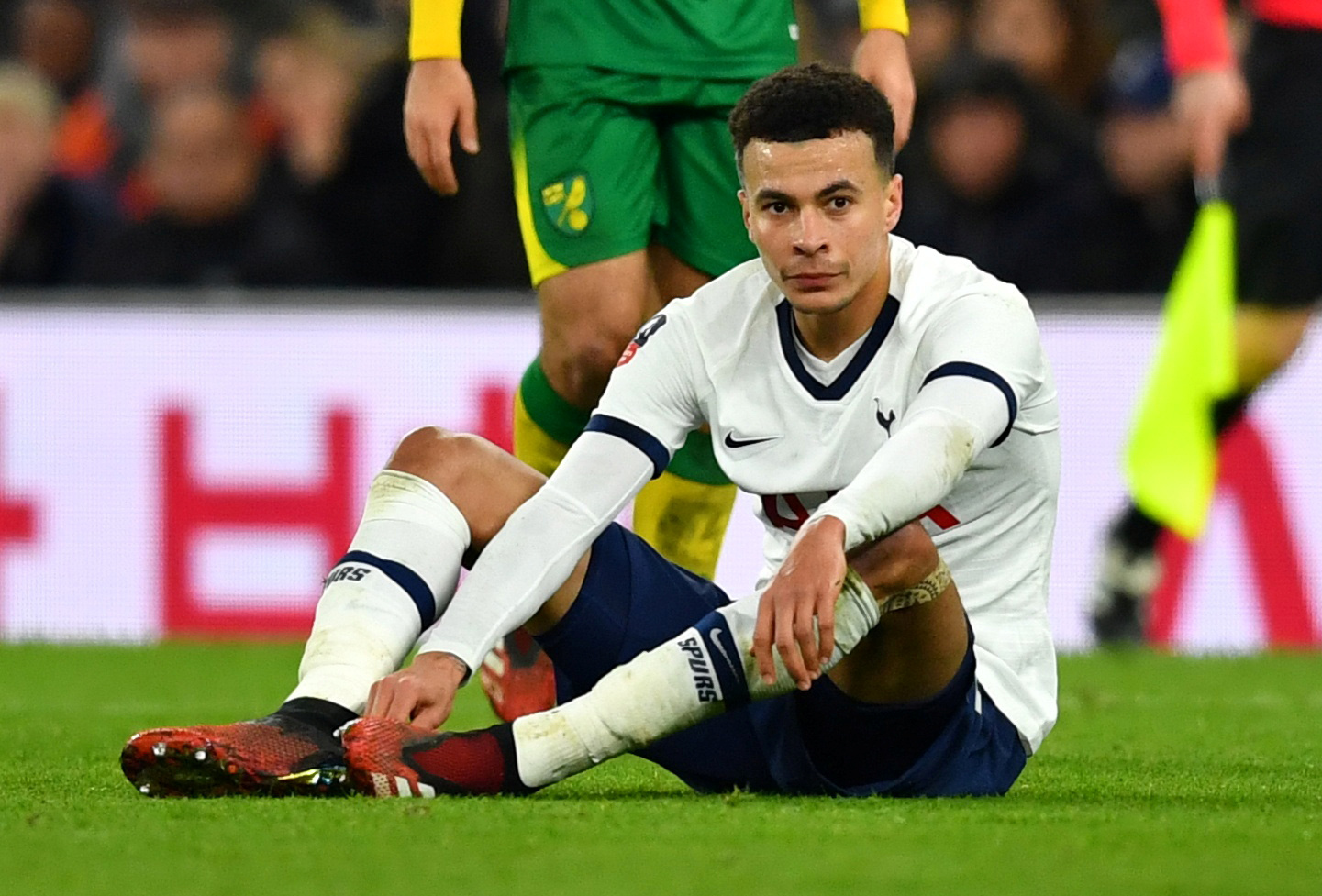 Jadi Korban Perampokan, Wajah Dele Alli Alami Luka Ringan