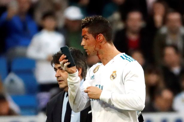Berlumuran Darah, Zinedine Zidane Pastikan Cristiano Ronaldo Baik Saja