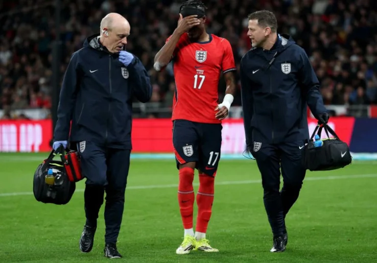 Dikhawatirkan Cedera, Tiga Pemain Arsenal Tinggalkan Skuad Timnas Inggris