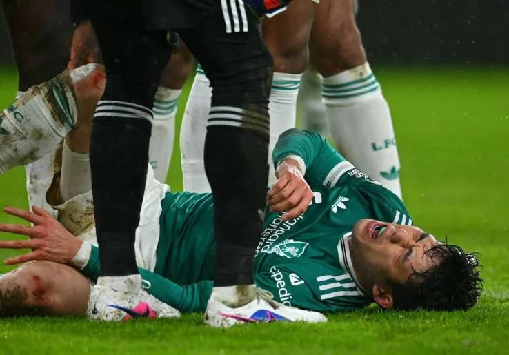 Krisis Bek Kanan Liverpool Kian Parah, Wataru Endo Juga Cedera