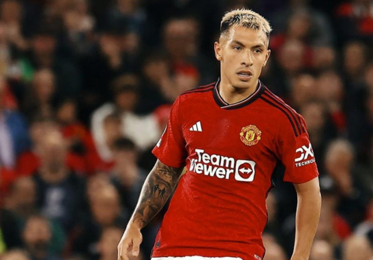 Soal Lisandro Martinez, Ruben Amorim Tidak Mau Ambil Risiko