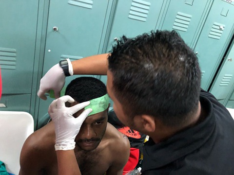 Sriwijaya FC Kutuk Pemukulan Terhadap Pemainnya Marco Meraudje