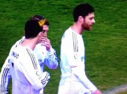 Madrid Menang, Kepala Ronaldo Ditimpuk Korek Gas
