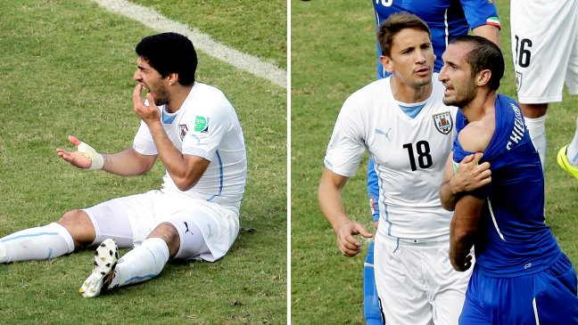 Wah, Gigitan Suarez Dijadikan Obyek Taruhan Judi