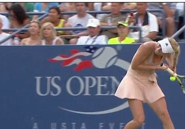VIDEO: Rambut Wozniacki Nyangkut di Raket